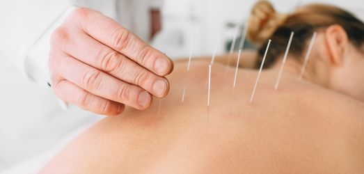 Acupuncture: techniques and conditions where it can be applied Juaneda